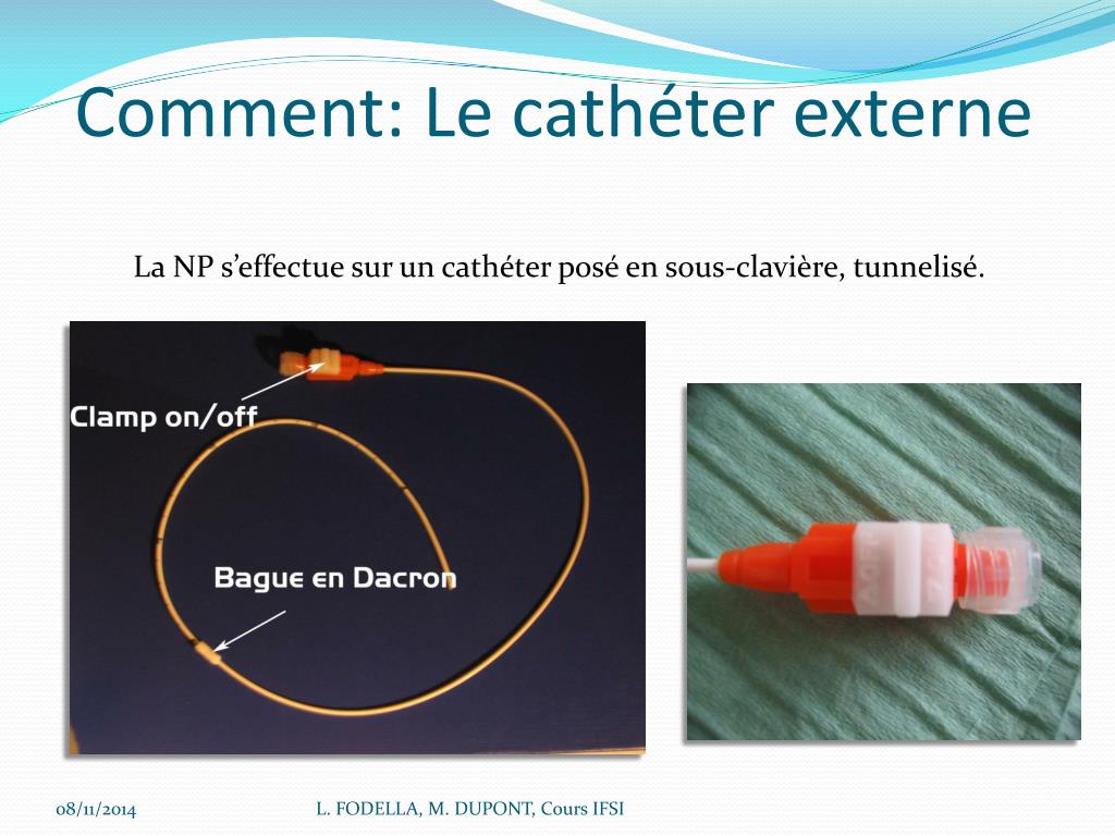 PPT - La Nutrition Parentérale au C.H.U. de NICE Unité Supports ...