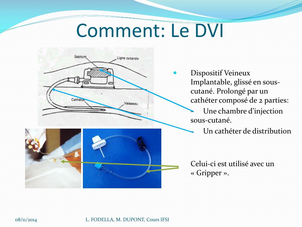 PPT - La Nutrition Parentérale au C.H.U. de NICE Unité Supports ...