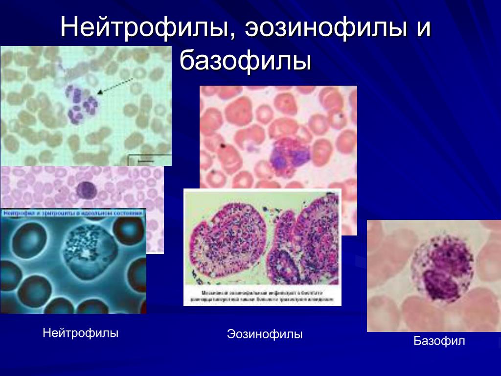 Лейкоциты нейтрофилы эозинофилы. Гранулоцитопоэз эозинофил. Базофилы нейтрофилы. Нейтрофилы азурофилы и. Базофилы эозинофилы нейтрофилы моноциты и лимфоциты.