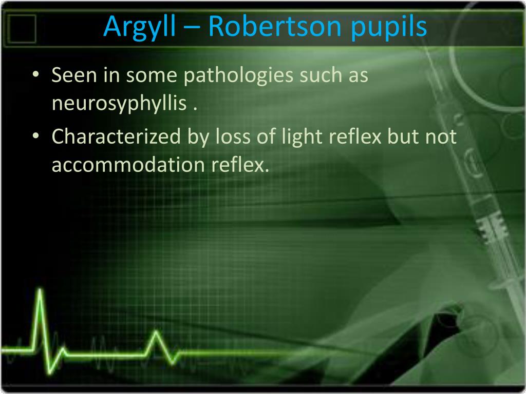 argyll robertson pupil afferent or efferent limb loss argyll robertson pupil afferent or efferent limb loss