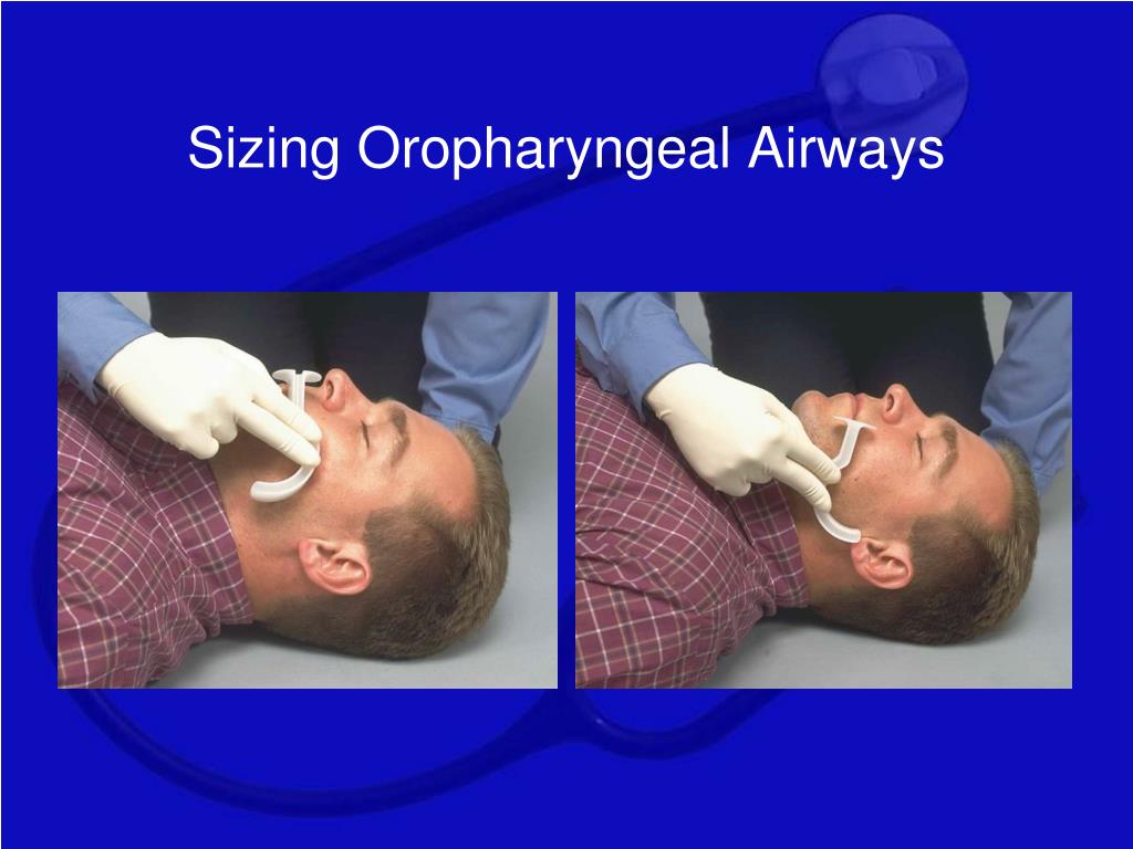 How To Measure Airway Size - Reverasite