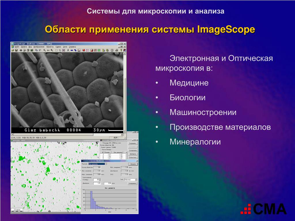 Методы сканирующей микроскопии. Электронная микроскопия область применения. Оптическая и электронная микроскопия. Электронная микроскопия в медицине. Оптическая микроскопия.