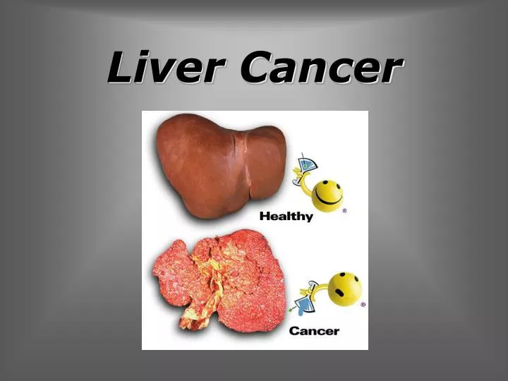 PPT Liver Cancer PowerPoint Presentation, free download ID6399378