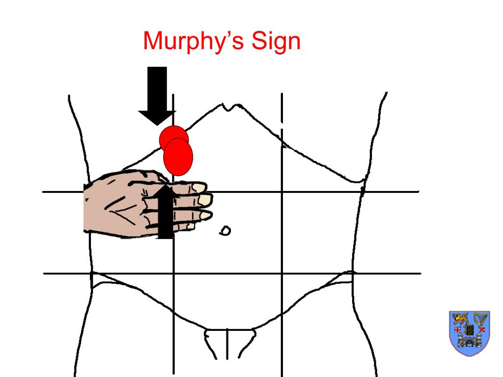 Murphy Zeichen Murphy Zeichen