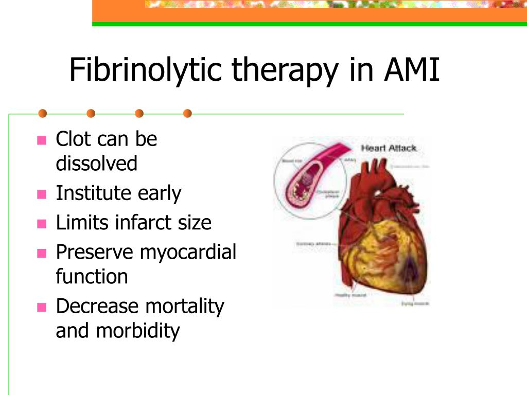 PPT FIBRINOLYTIC THERAPY PowerPoint Presentation, free download ID