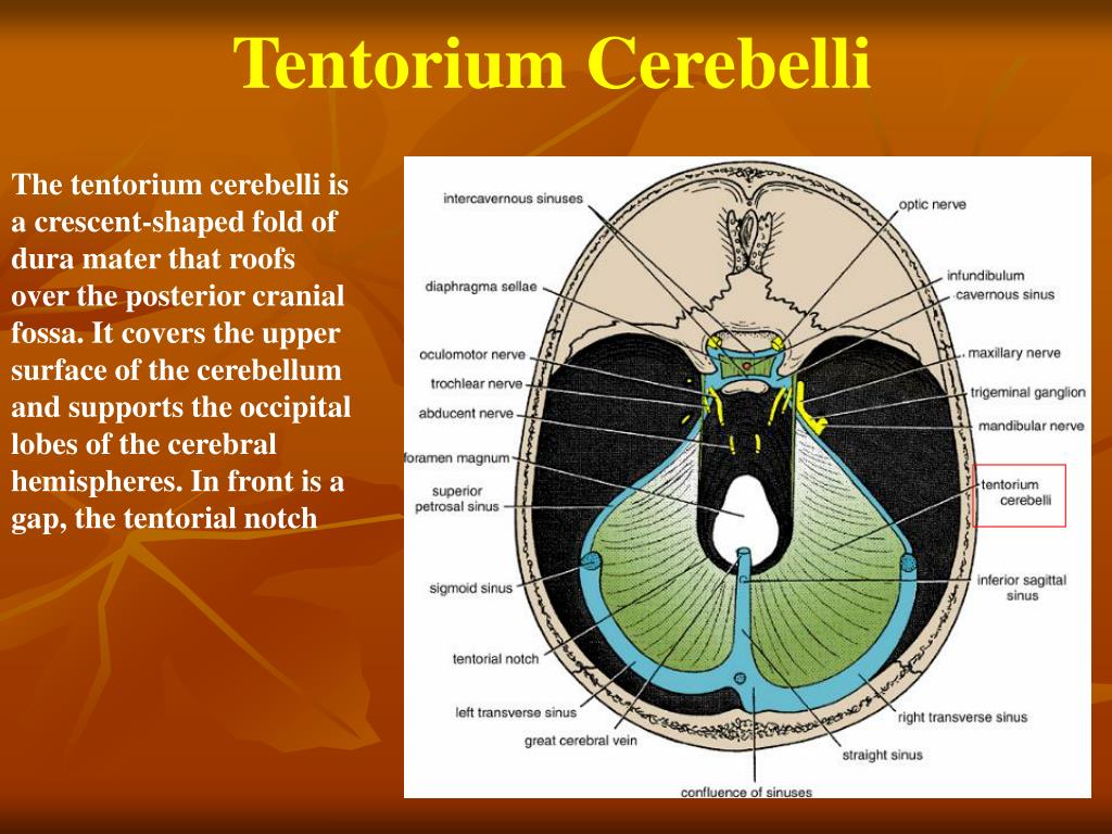 PPT The Inside View Of Cranium Is Known As PowerPoint Presentation PPT The Inside View Of Cranium Is Known As PowerPoint Presentation