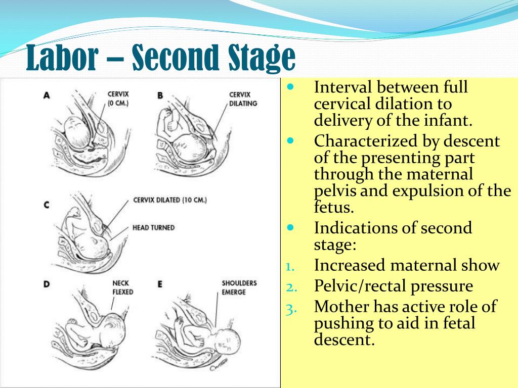 stage 2 labor