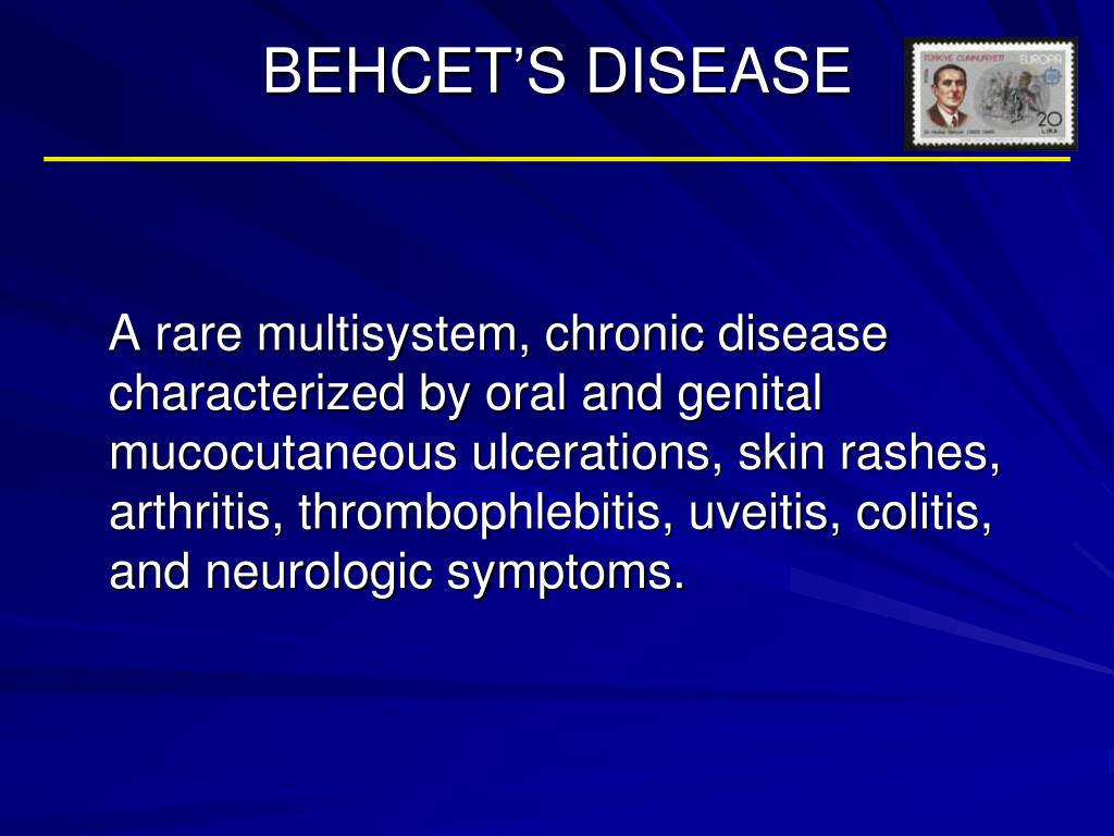 PPT - BEHCET'S DISEASE PowerPoint Presentation, free download - ID ...