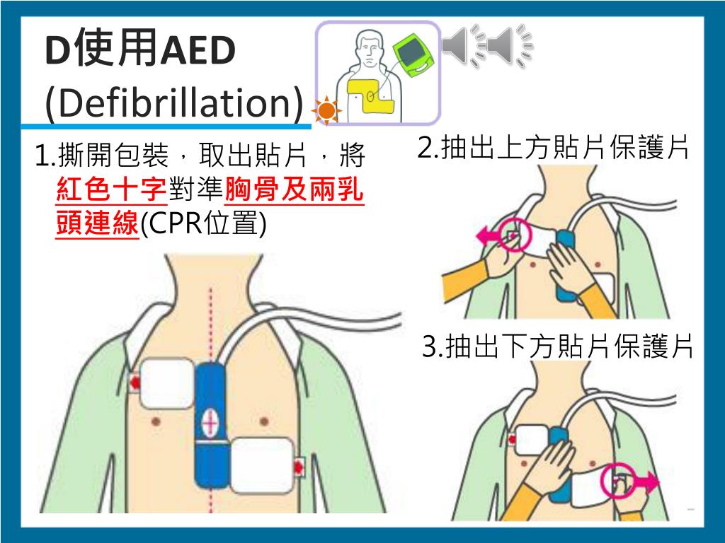 Ppt Zoll Medical Corporation Powerpoint Presentation Free Download Id 6480724