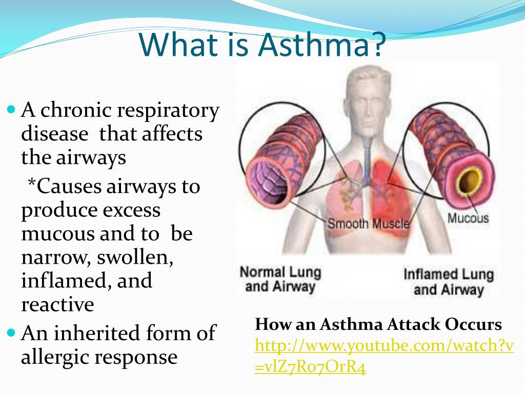 asthma presentation powerpoint