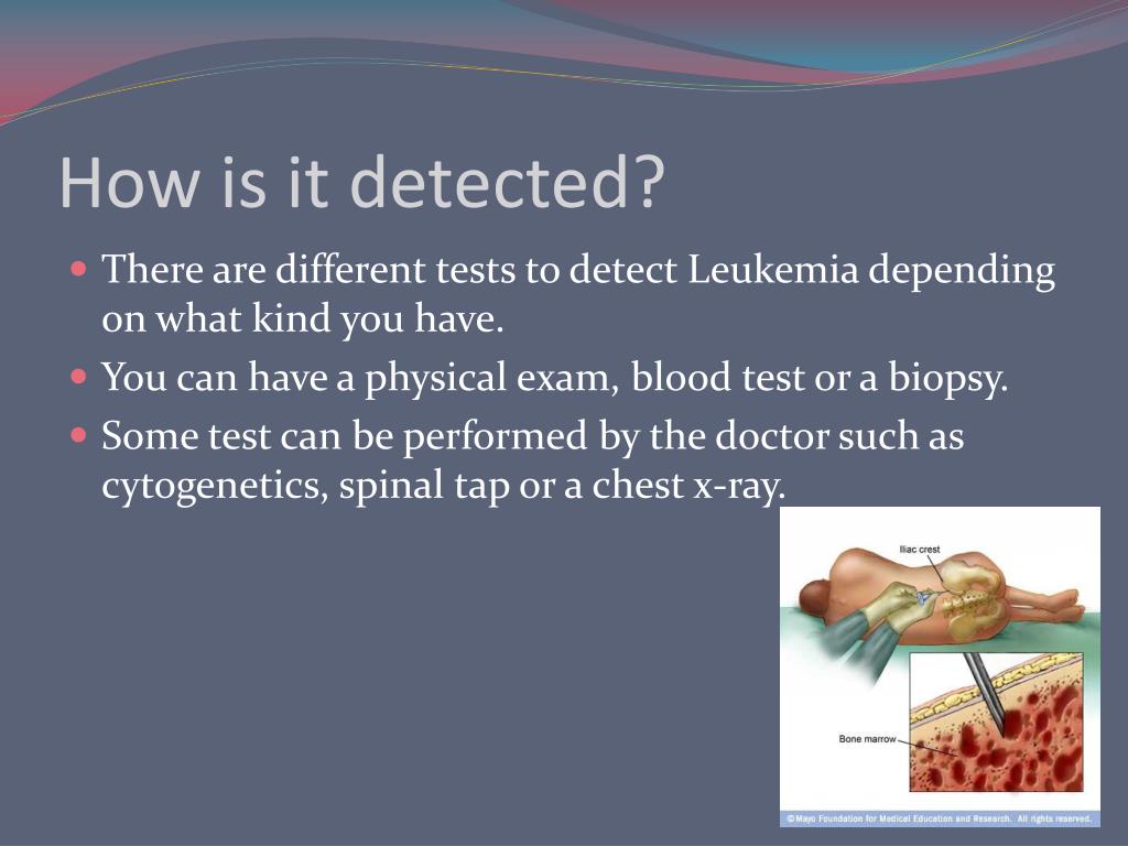 PPT Leukemia PowerPoint Presentation, free download ID6499963