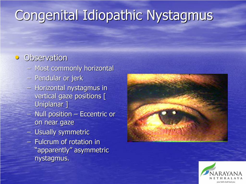 PPT Management of Nystagmus the Ophthalmologist’s perspective