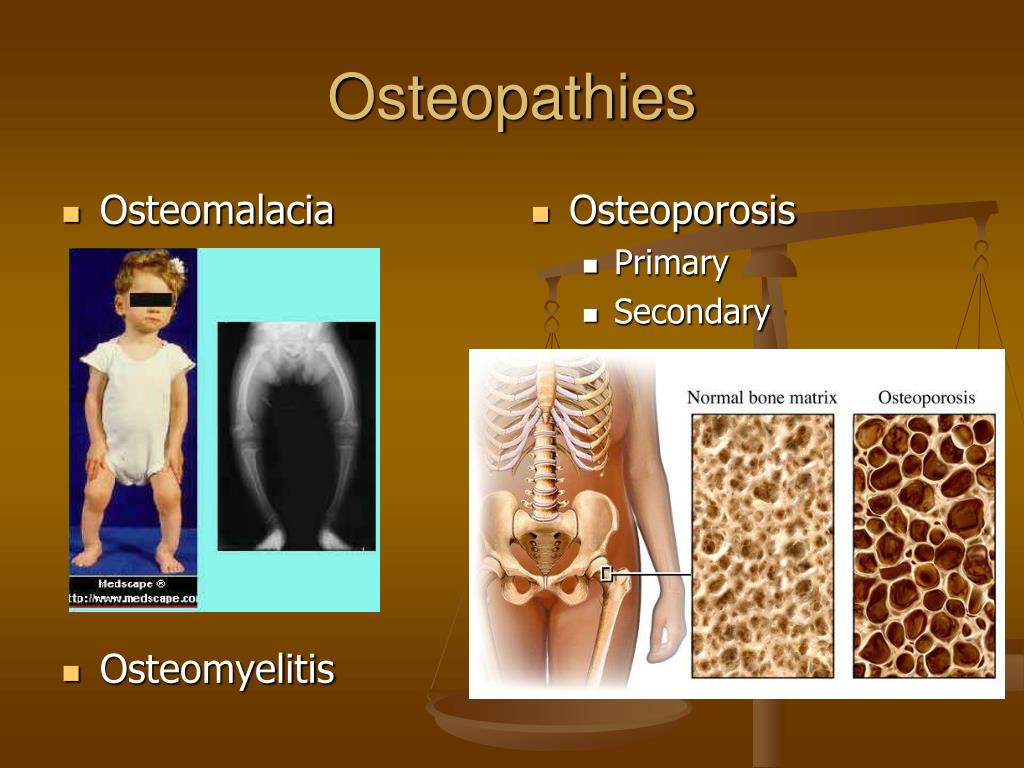 Ppt Orthopedic Pathology Powerpoint Presentation Free Download Id
