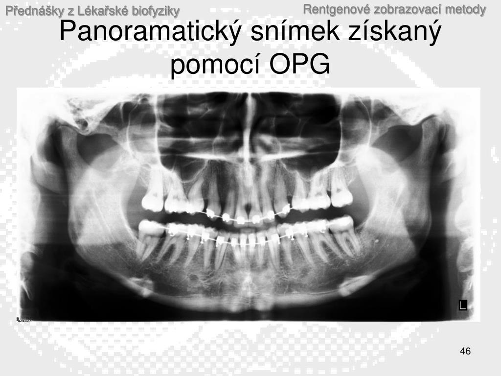 PPT - Přednášky z lékařské biofyziky Biofyzikální ústav Lékařské fakulty  Masaryk ovy univerzity, Brno PowerPoint Presentation - ID:6535223