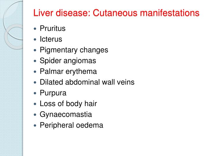 PPT - Skin and Systemic disease PowerPoint Presentation 