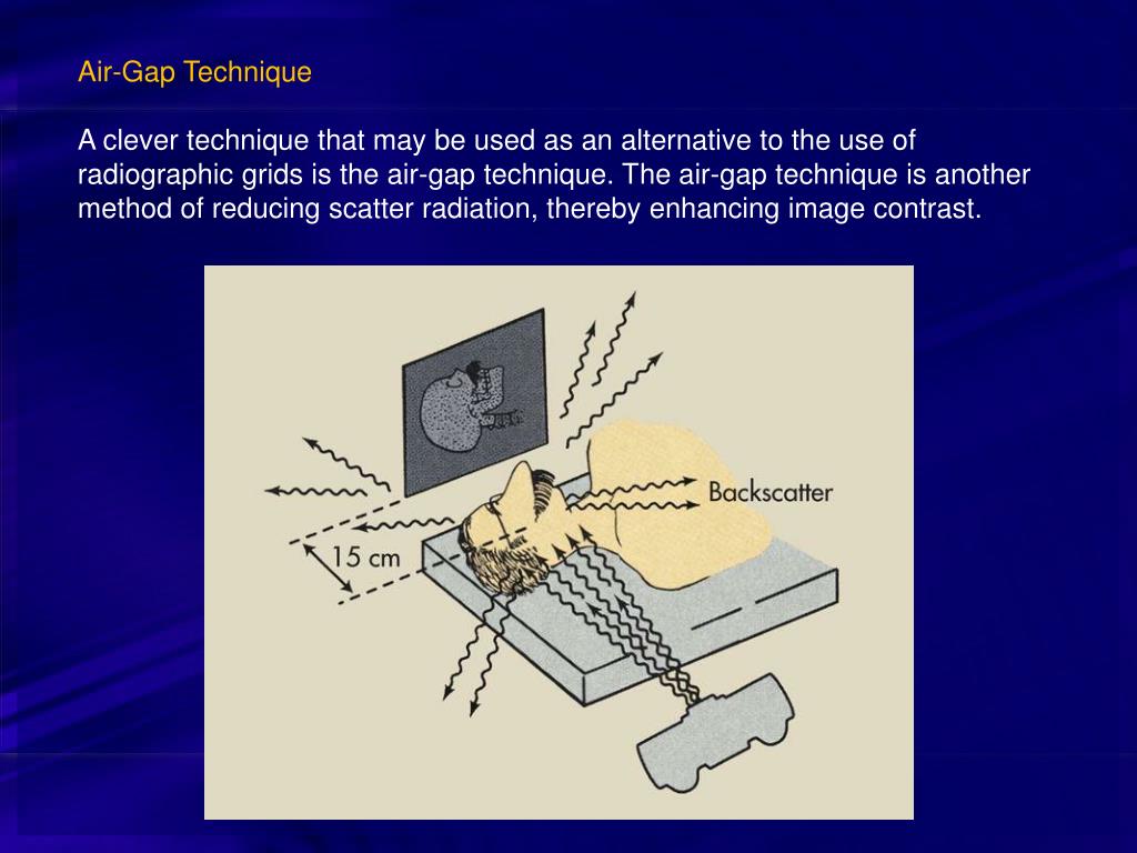 Radiography Grid Types Polftrax