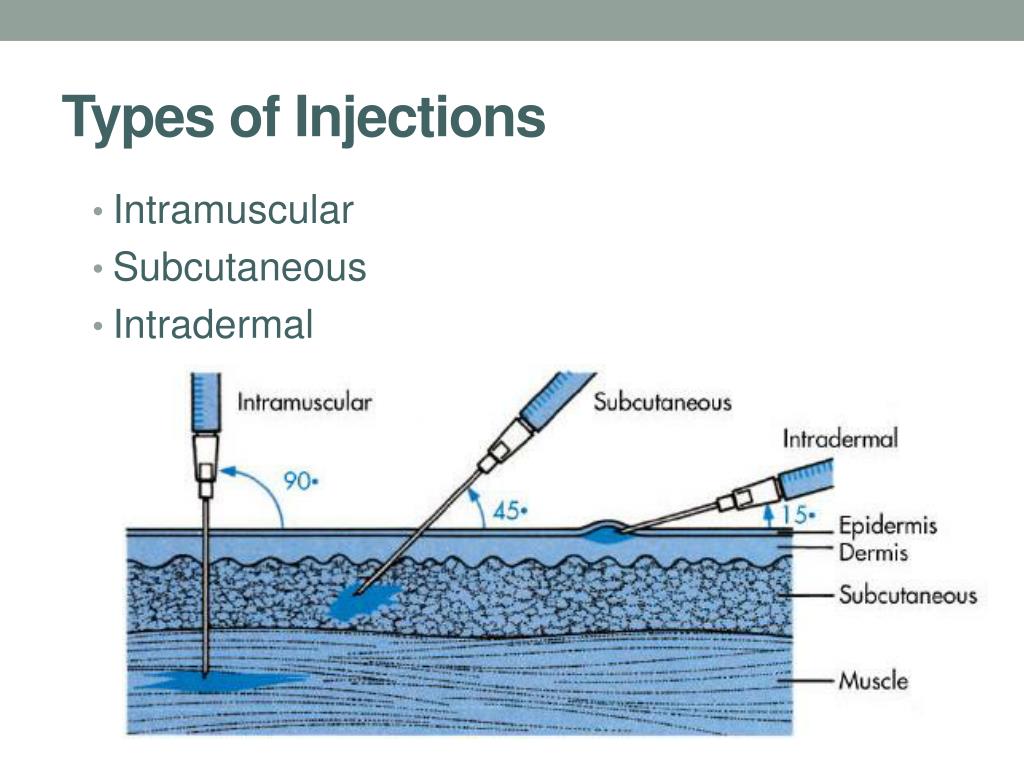 Injection Types