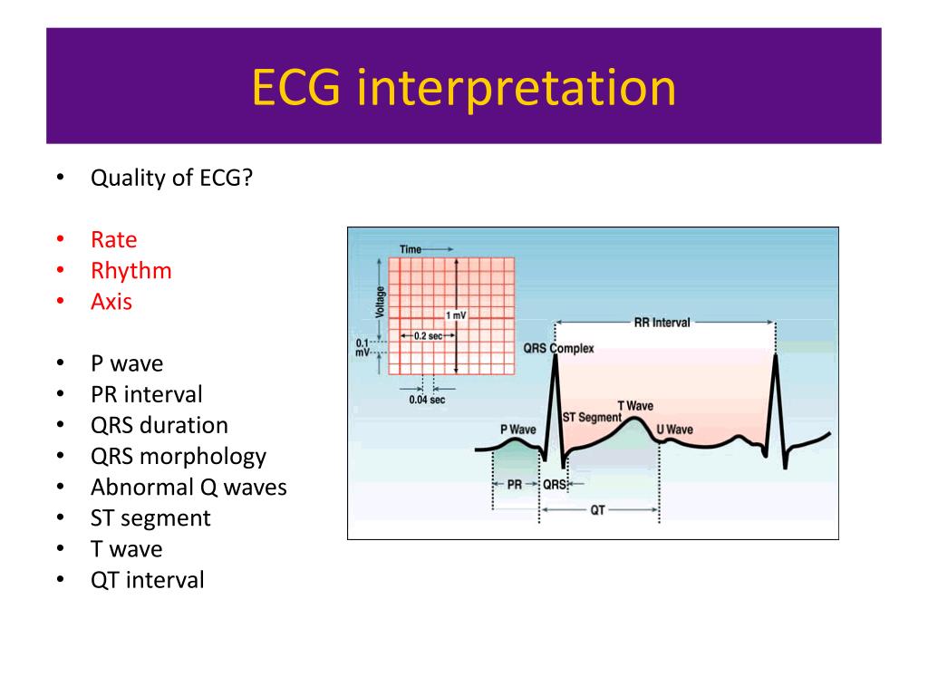 ecg powerpoint presentation download