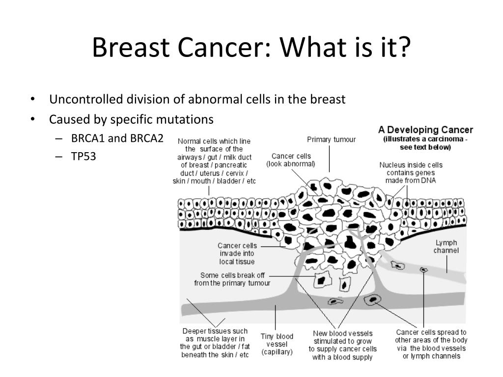 case study 63 cancer of the female breast