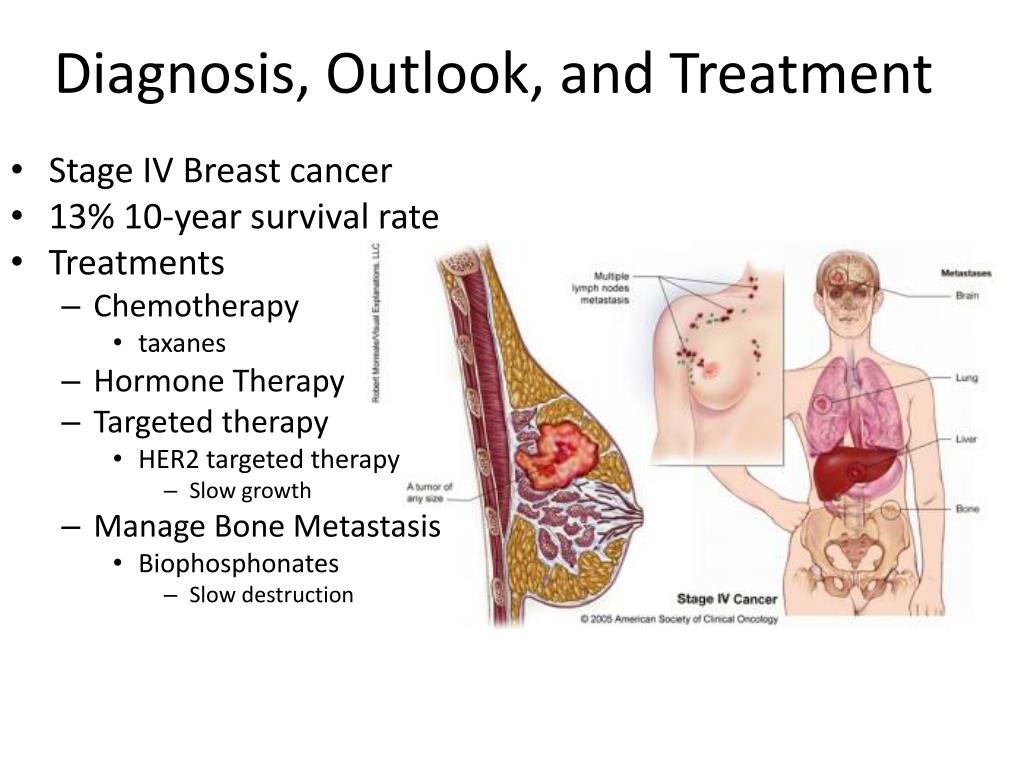 case study 63 cancer of the female breast
