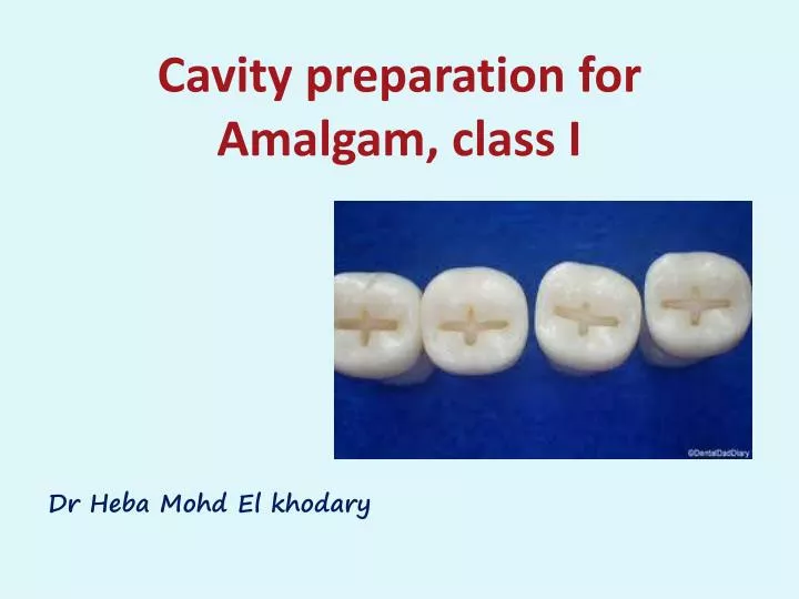 PPT Cavity preparation for Amalgam, class I PowerPoint Presentation
