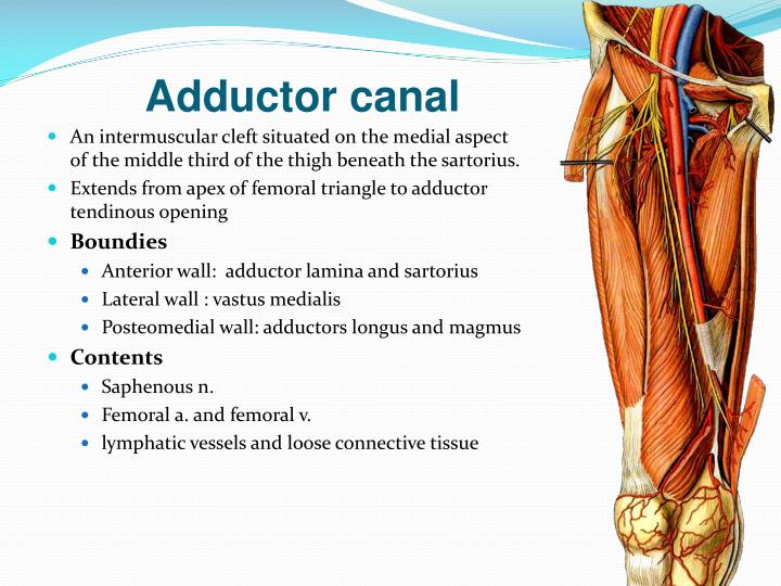 Adductor Canal Block Catheter