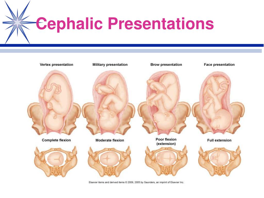 cephalic presentation in growth scan