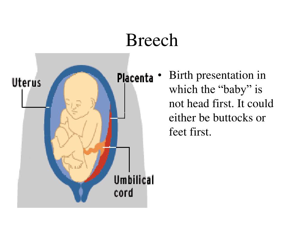 breech presentation with anterior placenta