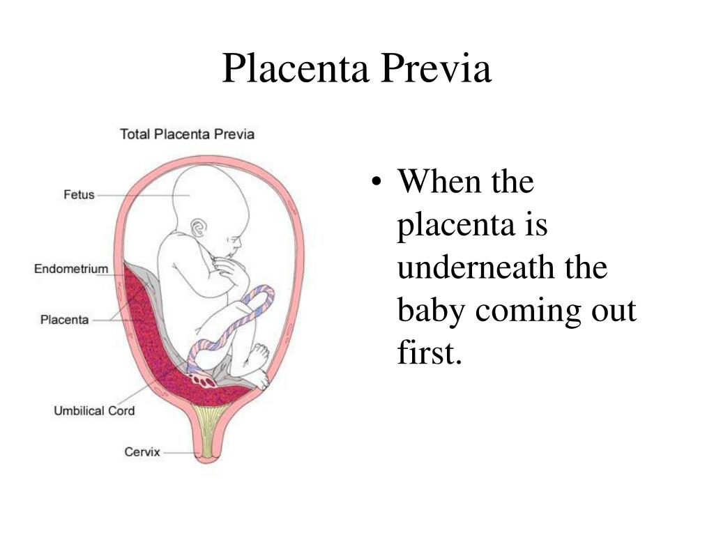 PPT - Placenta PowerPoint Presentation, free download - ID ...