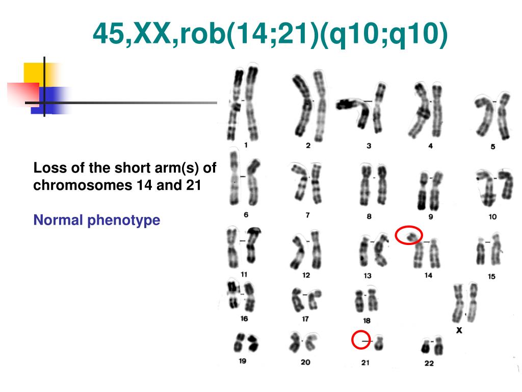 Кольцевая хромосома 2. 45 XX -21 кариотип. Кольцевая хромосома в кариотипе. 10. Кариотип.. ХХ хромосомы.