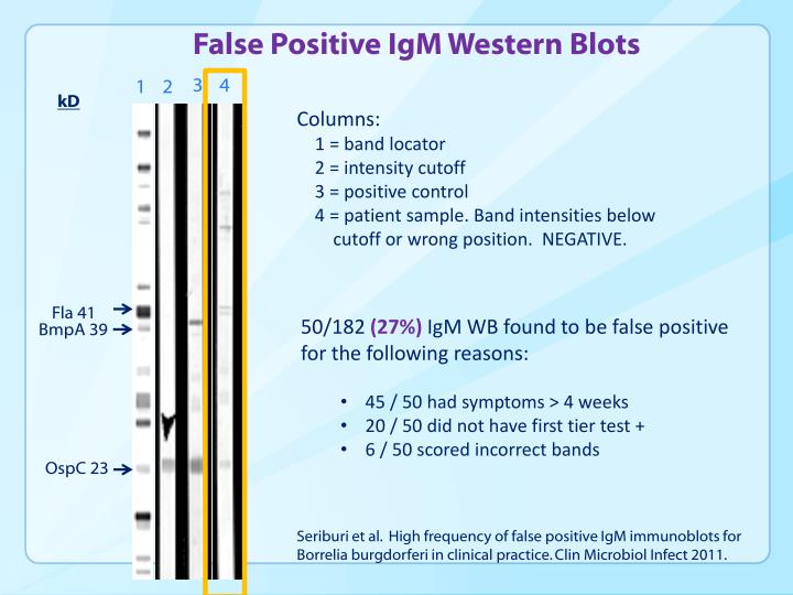 PPT Understanding Laboratory Testing for Lyme Disease PowerPoint