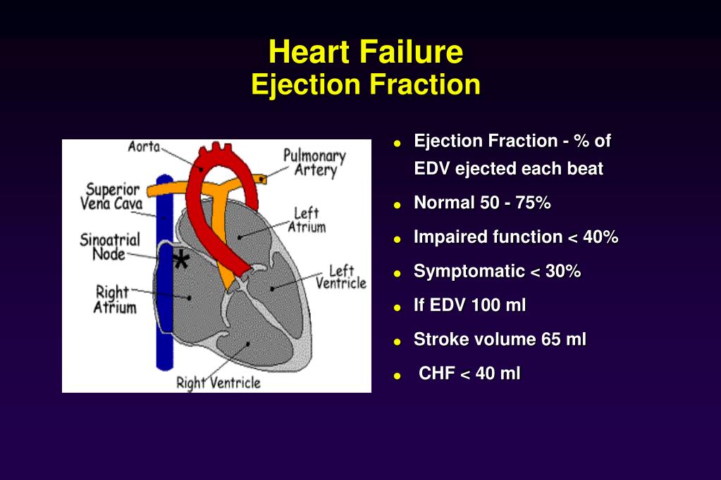 Congestive Heart Failure Diagram
