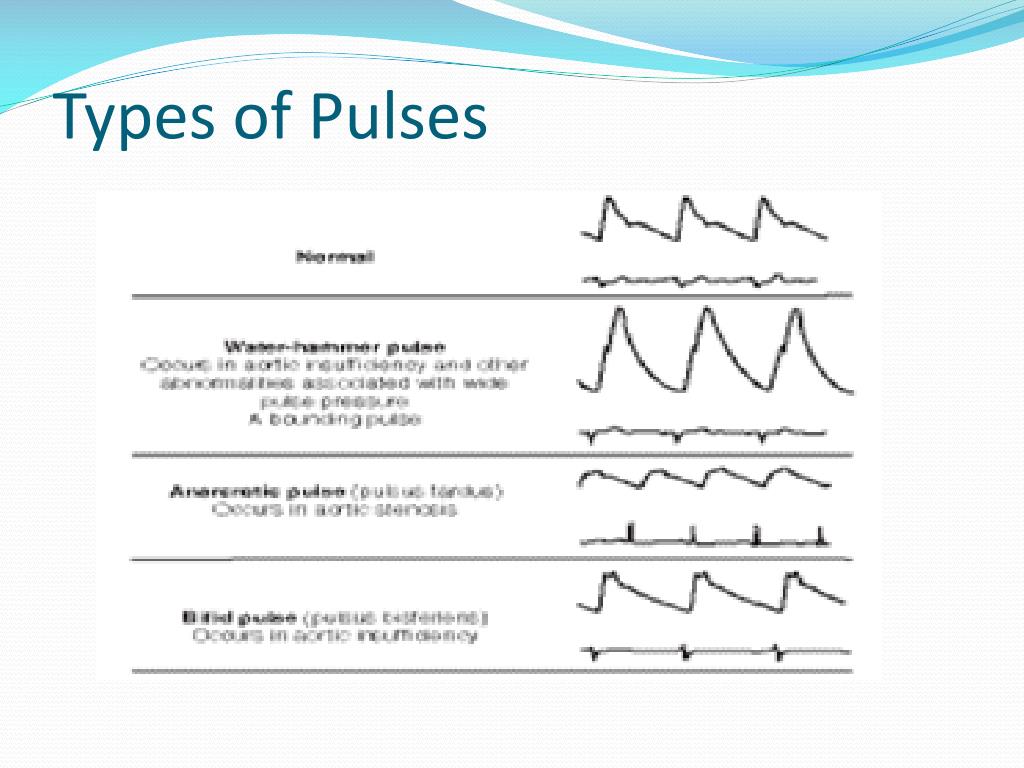 PPT The Arterial Pulse PowerPoint Presentation, free download ID