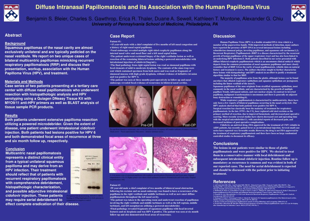 Human papilloma virus tratament Pagina 2 Nasal viral papilloma