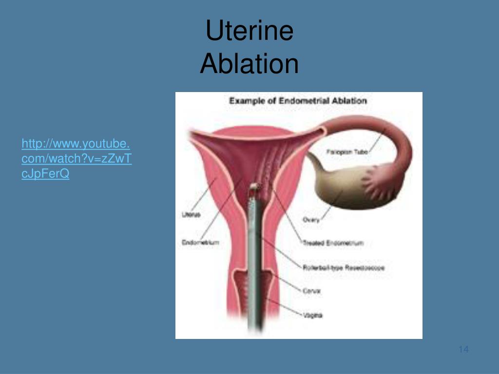 PPT Female and Male Reproductive System & HSG and Prostate Imaging PowerPoint Presentation