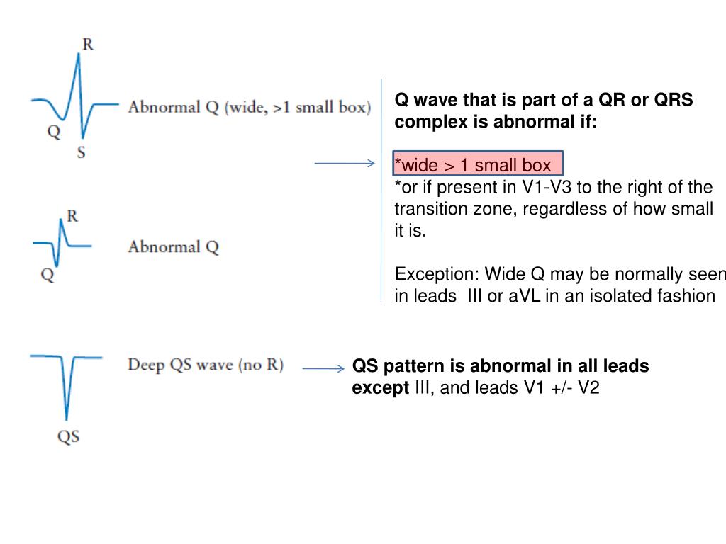 PPT ECG 1 PowerPoint Presentation, free download ID6591352