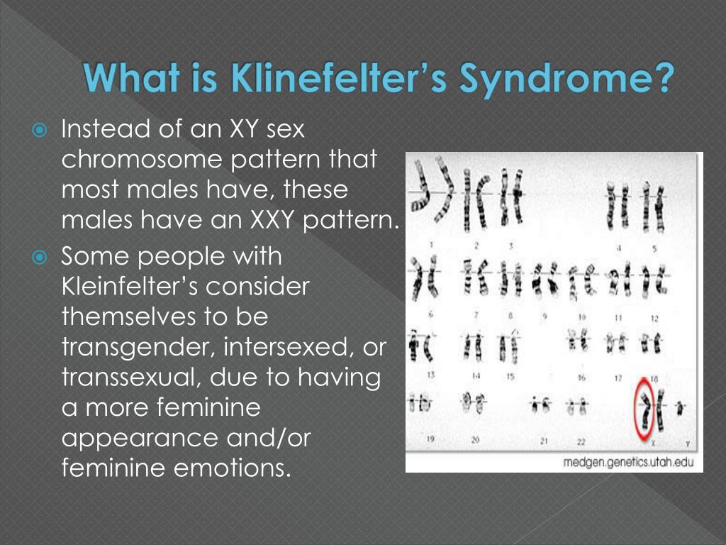 Ppt Klinefelters Syndrome Powerpoint Presentation Free Download