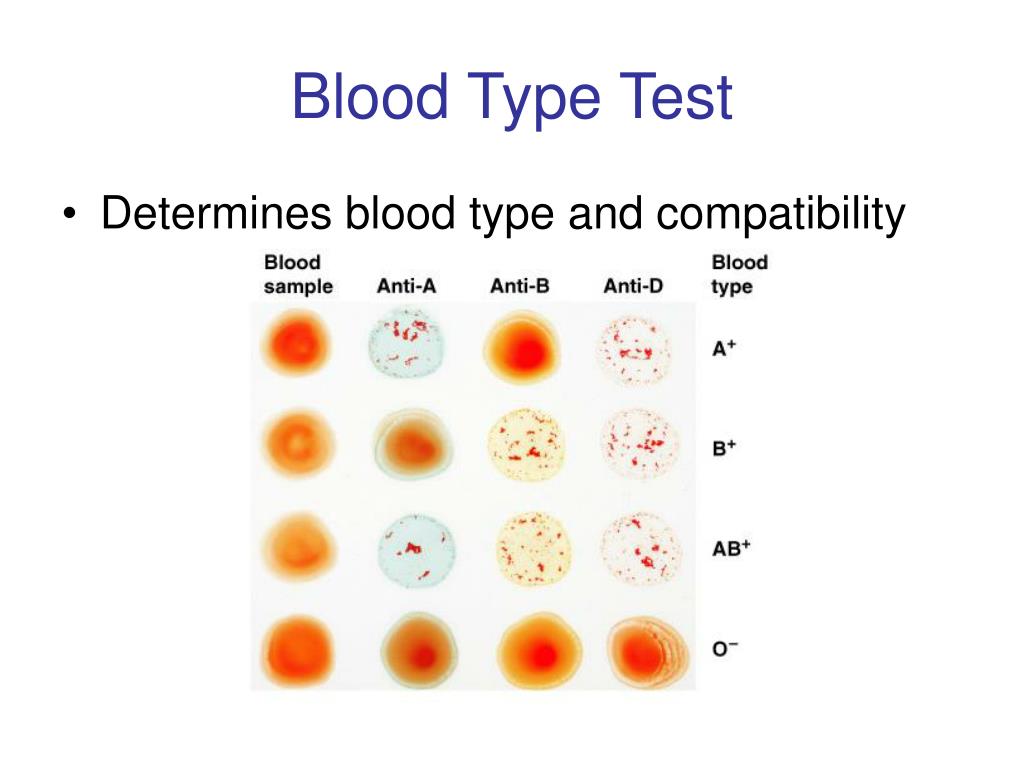 Blood Types Blood Types