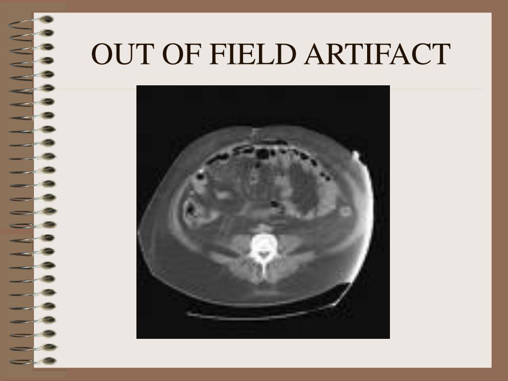 PDF) Ring artifact corrections in flat-panel detector based cone beam CT