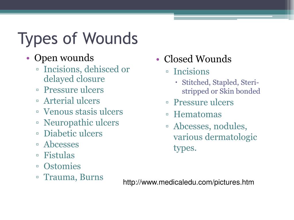 Types Of Open And Closed Wounds