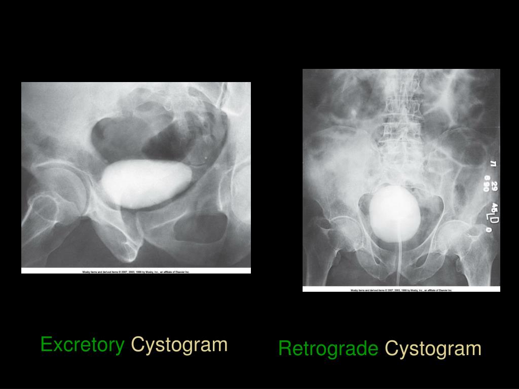 PPT The Urinary System PowerPoint Presentation, free download ID