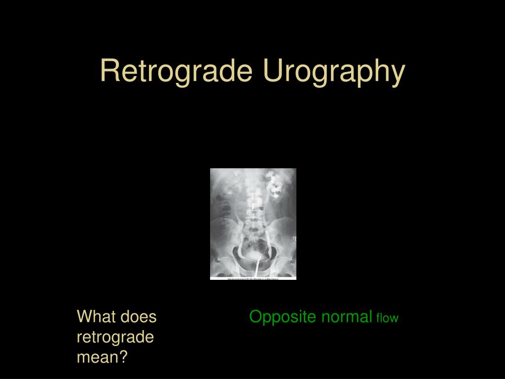 PPT The Urinary System PowerPoint Presentation, free download ID