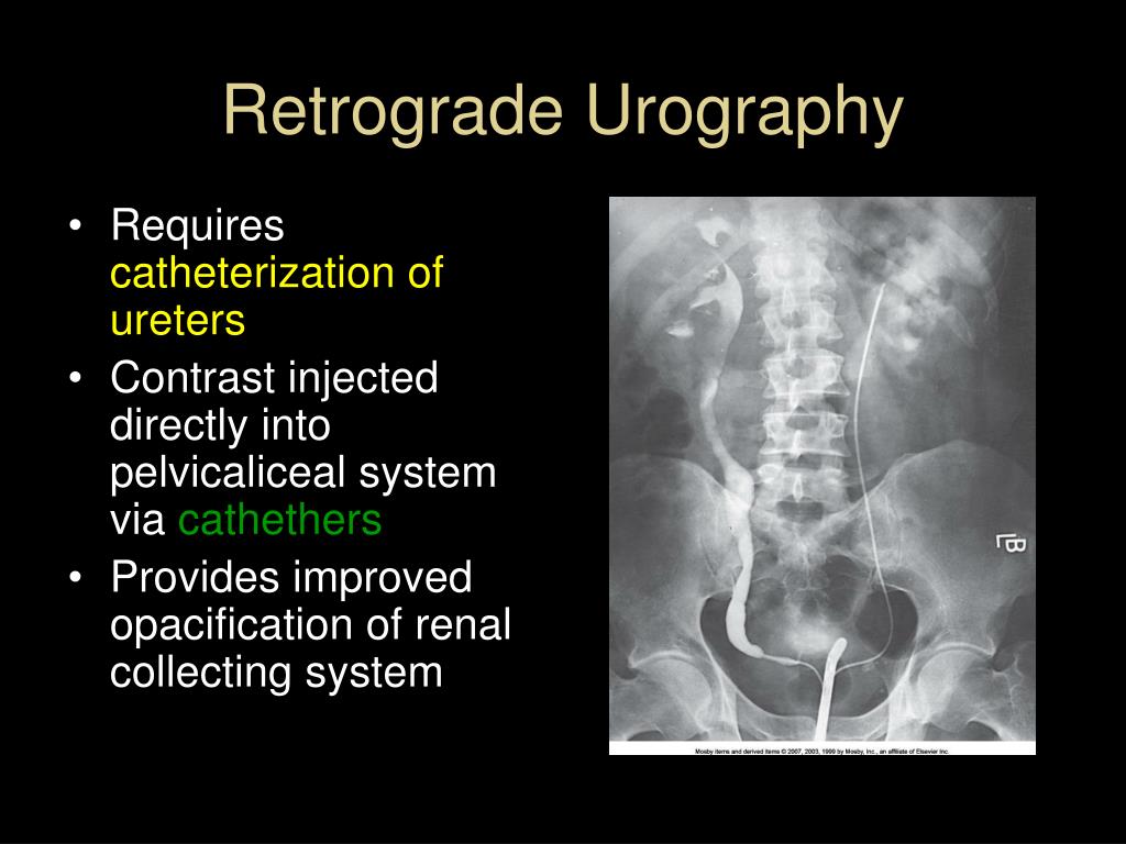 retrograde urography meaning