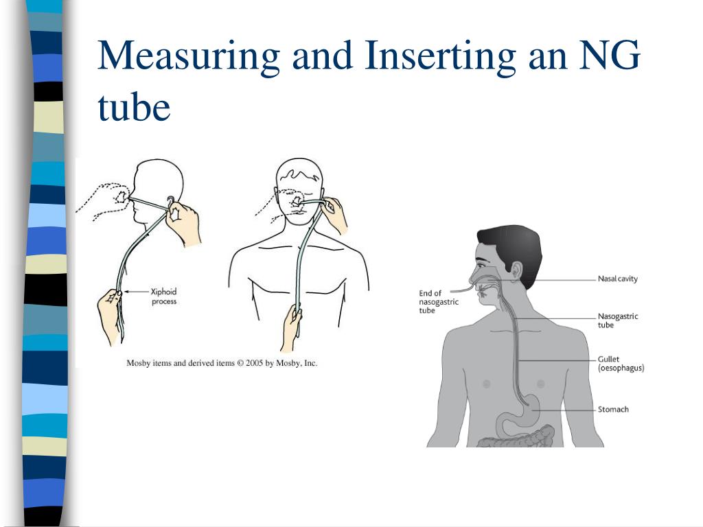 Ppt Nasogastric And Gastrointestinal Intubations Powerpoint