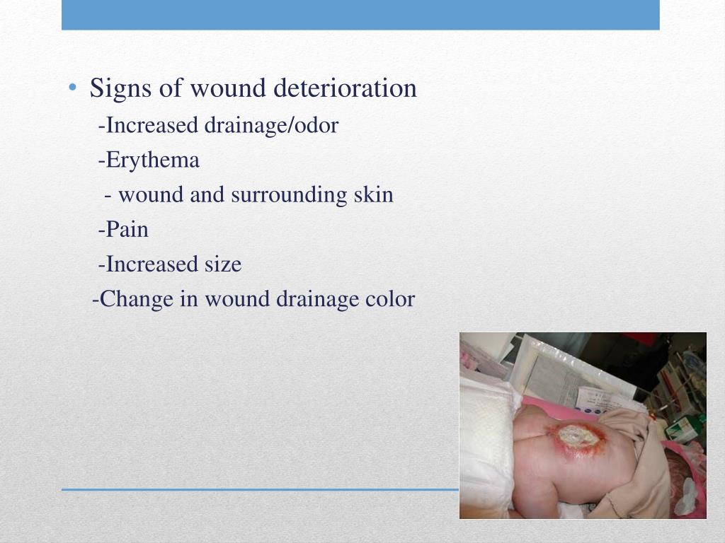wound drainage color