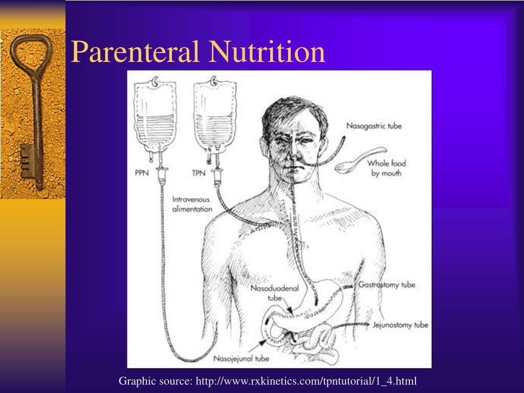 Discover 133+ types of parenteral nutrition bags best - esthdonghoadian