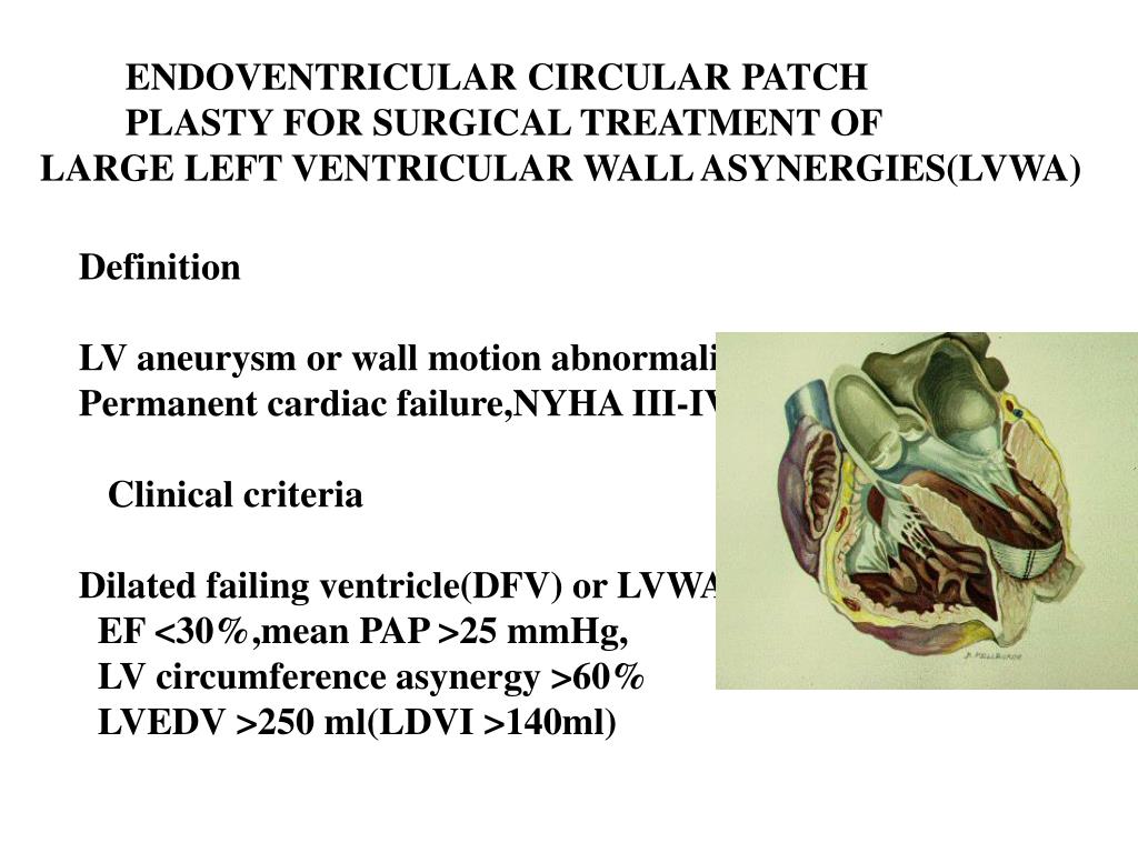 PPT - Aortic Aneurysm PowerPoint Presentation - ID:6599578