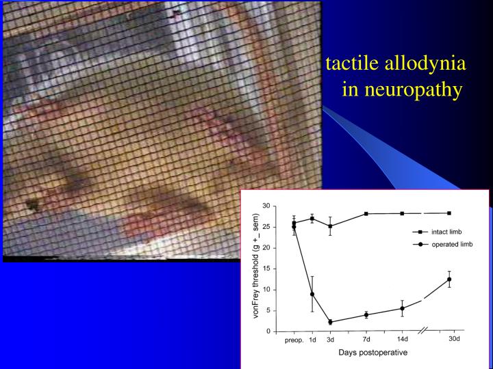 Treatment Of Allodynia