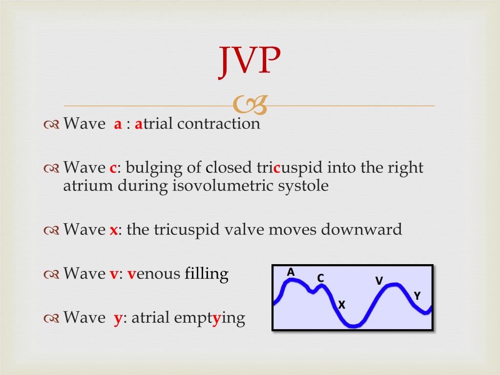 A V Wave Jvp