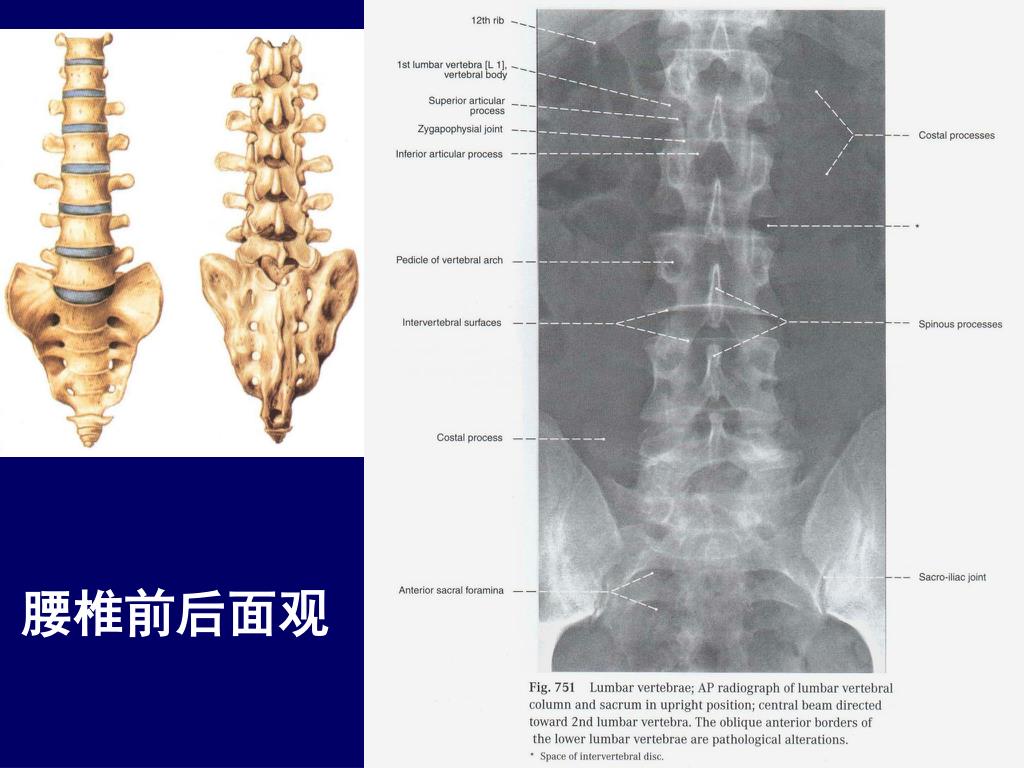 图6-11 经第2腰椎体上份的横断层-基础医学-医学